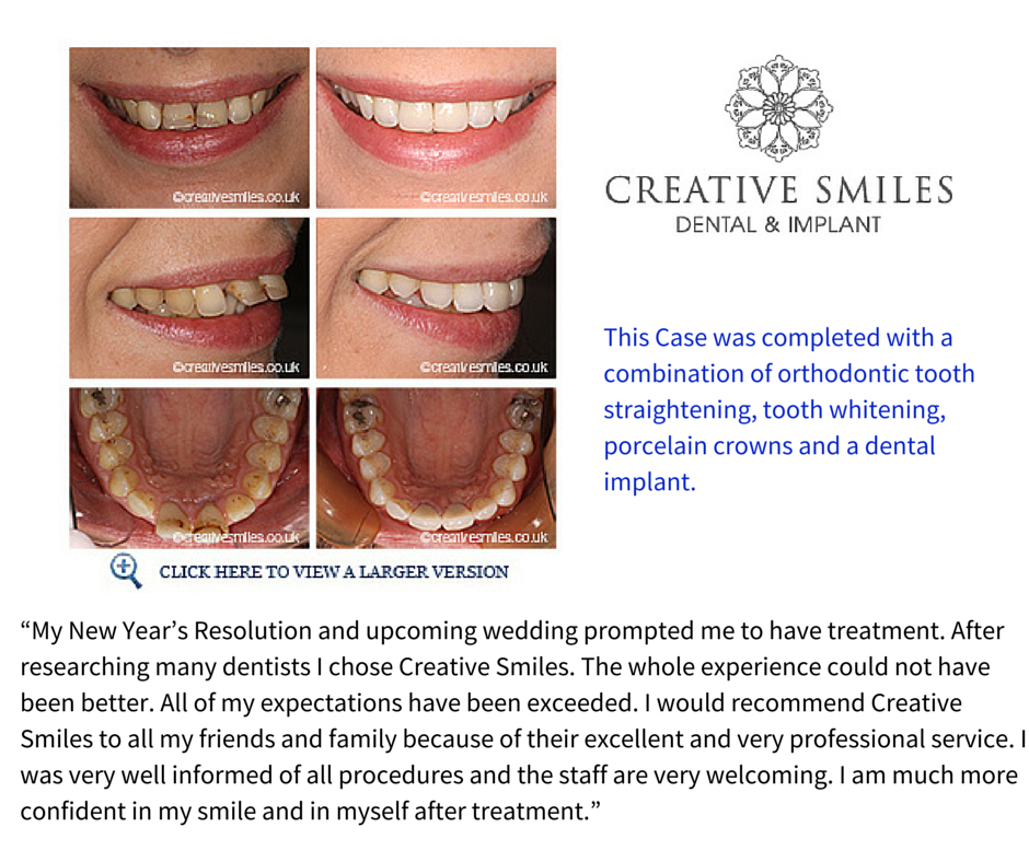 Creative Smiles Cosmetic Dentist, Belfast Cosmetic Dentists Northern