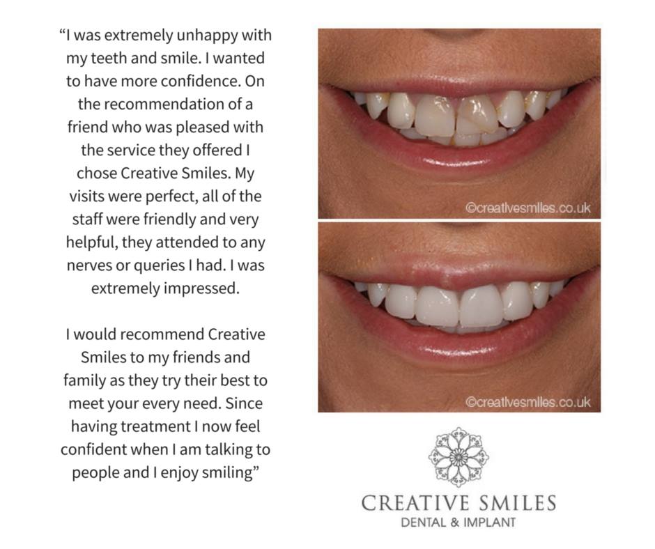 Creative Smiles Cosmetic Dentist, Belfast Cosmetic Dentists Northern