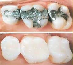 Derrylin Dental and Implant Centre Fermanagh dentist