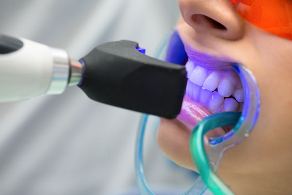Dental treatment at Derrylin Dental and Implant Centre