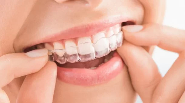 Cosmetic dentistry at Derrylin Dental and Implant Centre