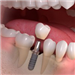 gallery thumbnail image